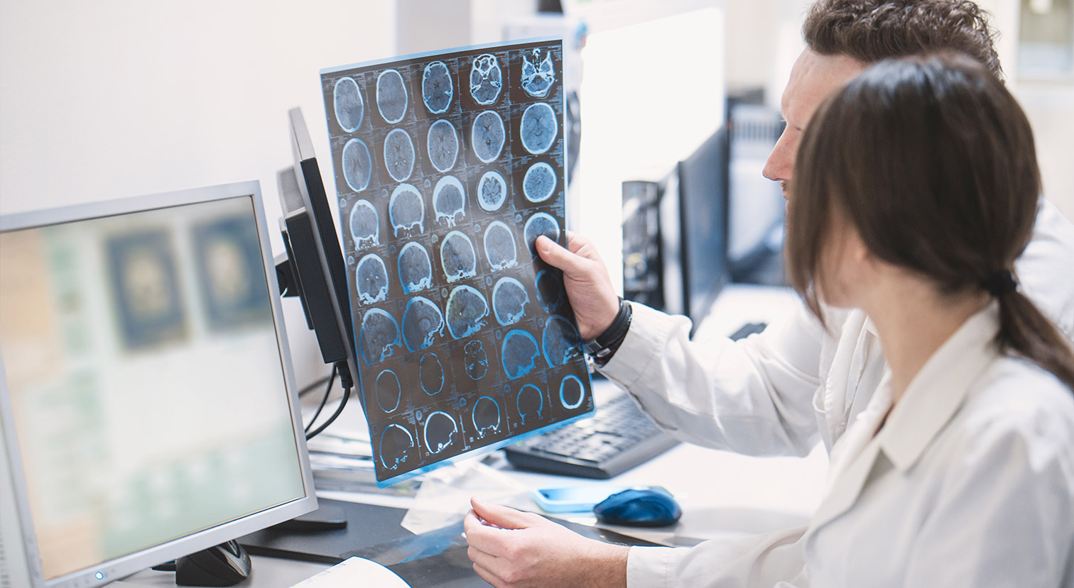 Multiple Sclerosis (MS) Image